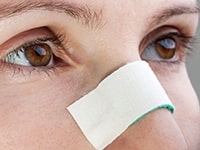 Nasal Fracture in Great Neck, NY