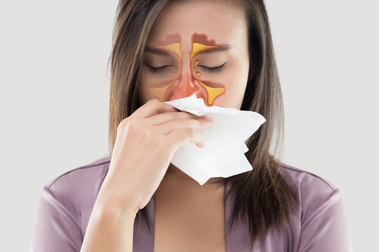 Balloon Sinuplasty™ for Chronic Sinusitis Relief